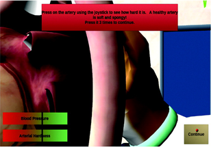 VB-F&V Arterial Elasticity Heath Check A major artery of a heart inside a lab.